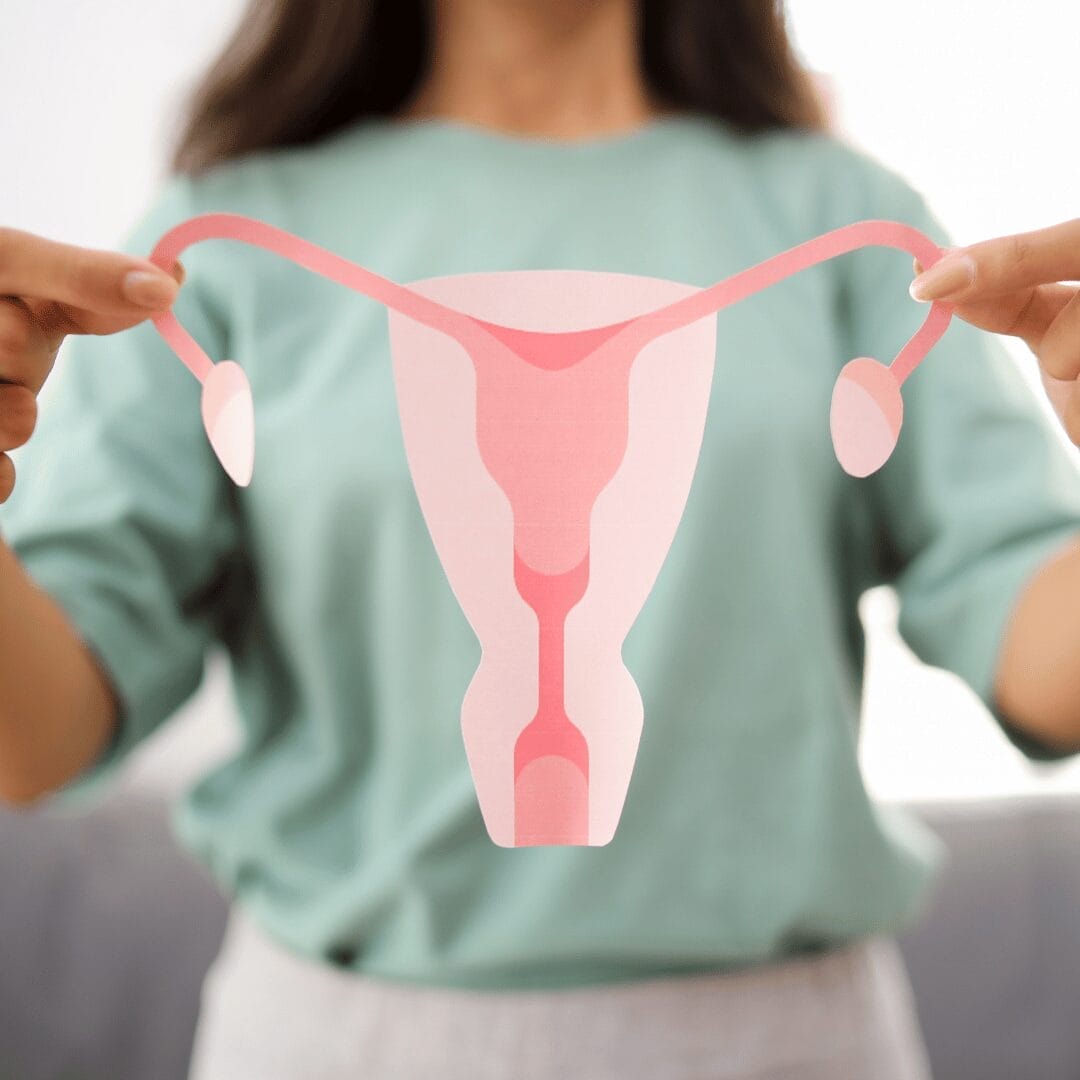 PCOS Renamed to PMOS: New Name, the Same Old Fight
